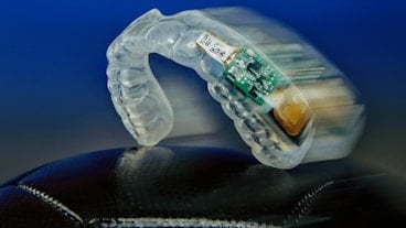 Navigating Complex Design Challenges: Artec Design Leveraged Renesas Components for Smart Mouthguard Innovation