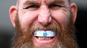 Man with mouthguard