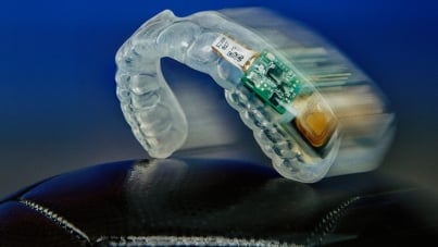 Navigating Complex Design Challenges: Artec Design Leveraged Renesas Components for Smart Mouthguard Innovation